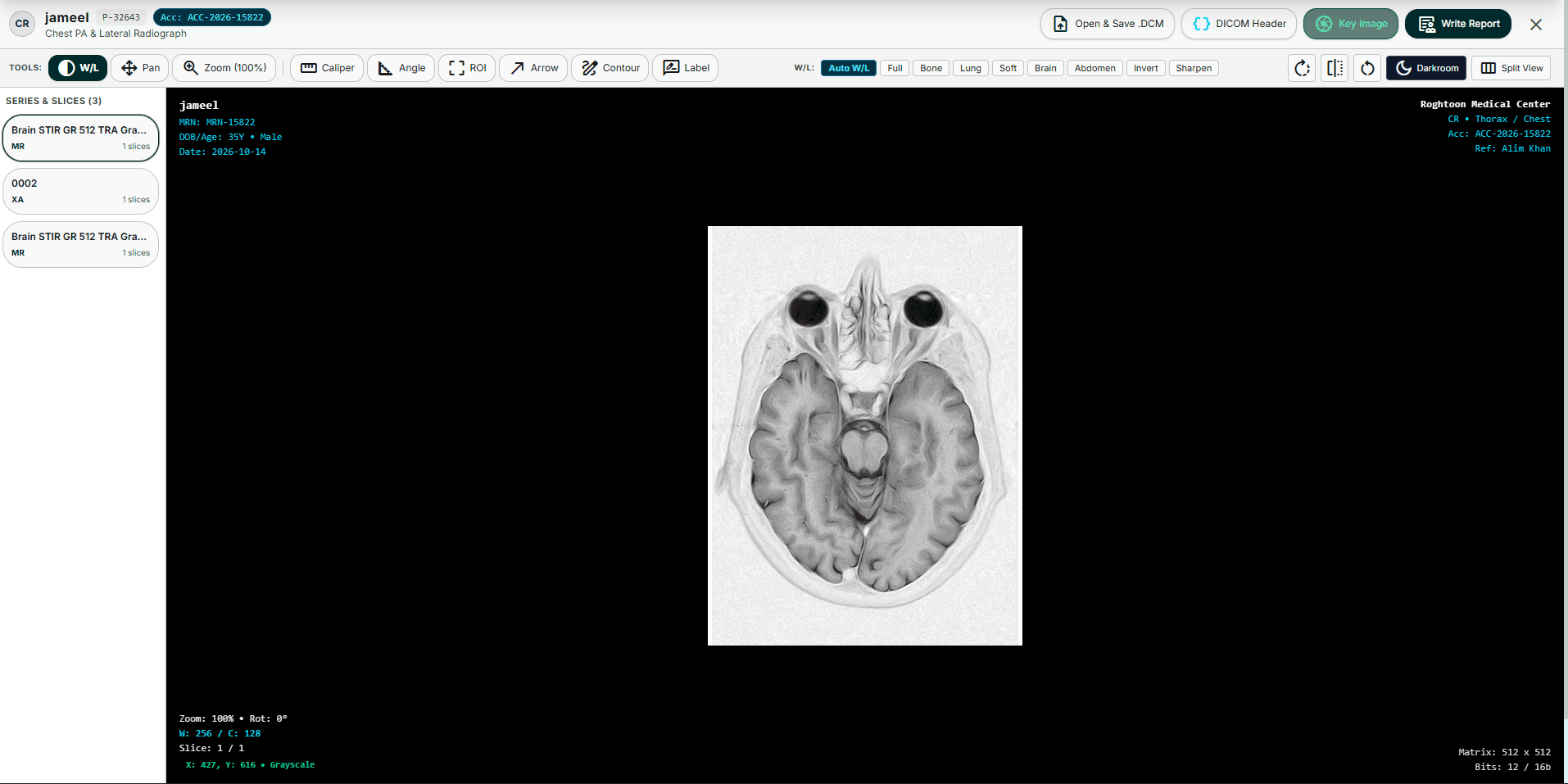 Roghtoon Web DICOM Radiology Viewer & Worklist